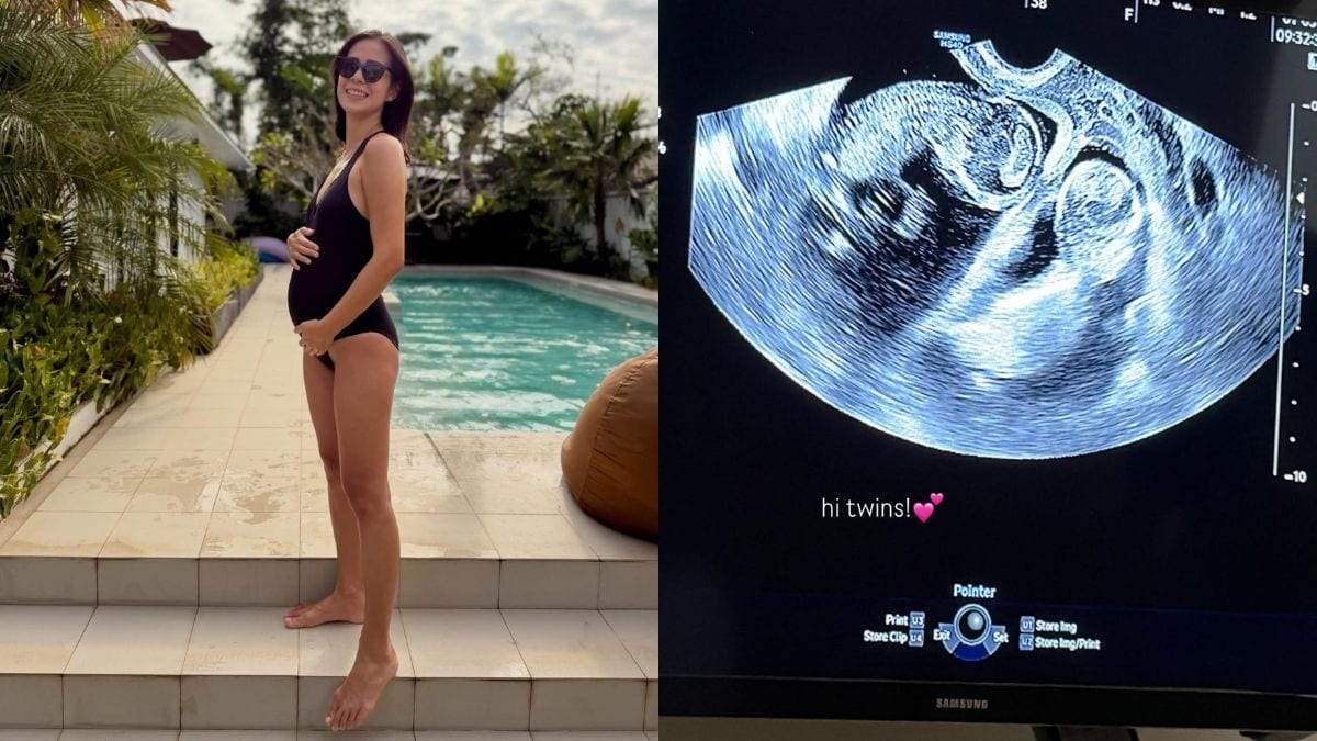 Bettinna Carlos Eduardo is Pregnant with Twins!